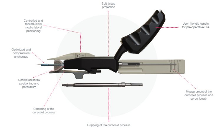 HyLa (Hybrid Latarjet) - a Mini-Open/Arthroscopy Combo System
